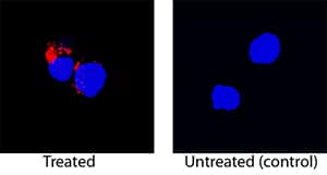 IL-1 beta/IL-1F2 antibody in Rat Splenocytes by Immunocytochemistry (ICC).