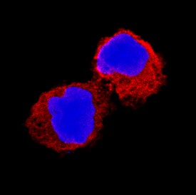IL-1 beta/IL-1F2 antibody in Human PBMCs by Immunocytochemistry (ICC).