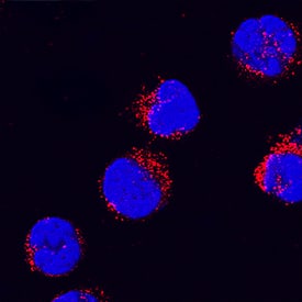 IL-1 beta/IL-1F2 antibody in Human PBMCs by Immunocytochemistry (ICC).