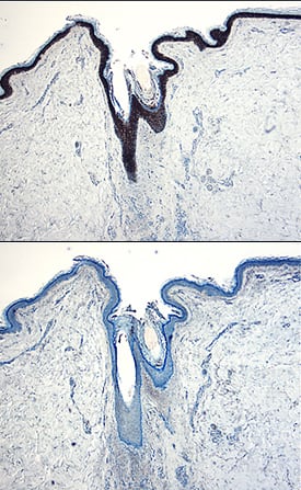 IL-1ra/IL-1F3 antibody in Human Skin by Immunohistochemistry (IHC-P).