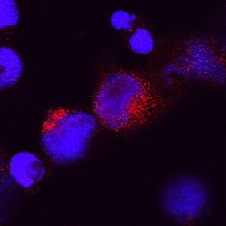 IL-28A/IFN-?2 antibody in Human PBMCs by Immunocytochemistry (ICC).