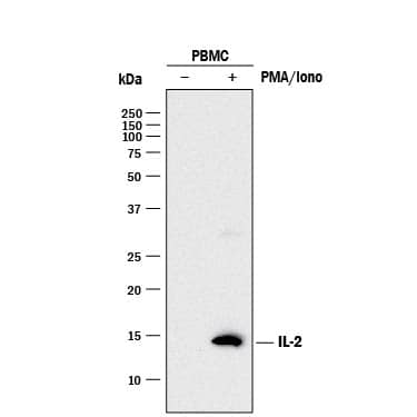 Detection of Human IL-2 antibody by Western Blot.