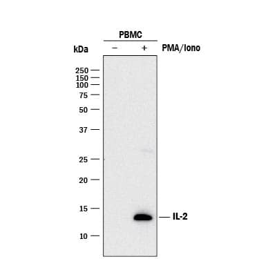 Detection of Human IL-2 antibody by Western Blot.