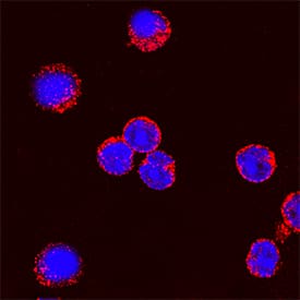 IL-2 antibody in Rat Splenocytes by Immunocytochemistry (ICC).