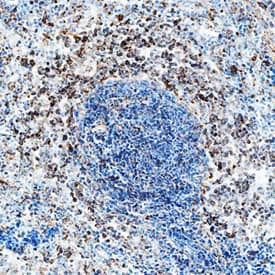 IL-2 antibody in Rat Spleen by Immunohistochemistry (IHC-Fr).