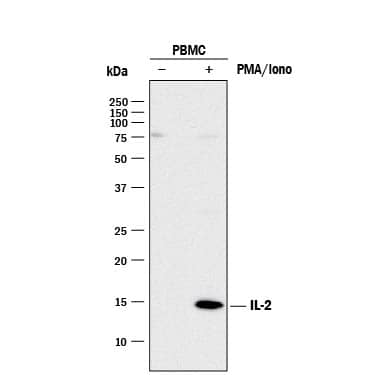 Detection of Human IL-2 antibody by Western Blot.