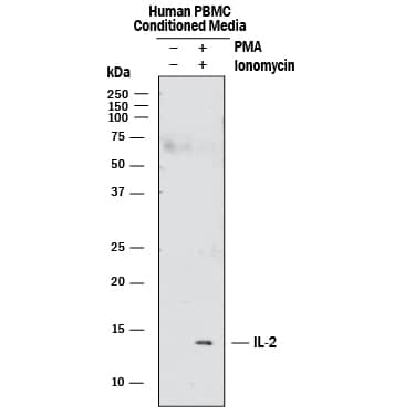 Detection of Human IL-2 antibody by Western Blot.