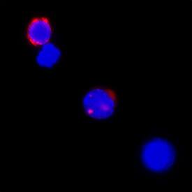 IL-2 antibody in Human PBMCs by Immunocytochemistry (ICC).