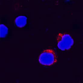 IL-31 antibody in Human PBMCs by Immunocytochemistry (ICC).