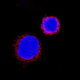 IL-31 RA antibody in K562 Human Cell Line by Immunocytochemistry (ICC).