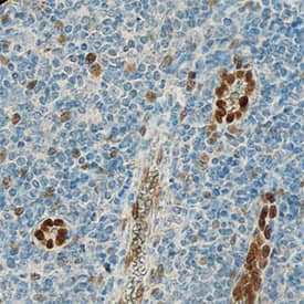 IL-33 antibody in Human Tonsil by Immunohistochemistry (IHC-P).
