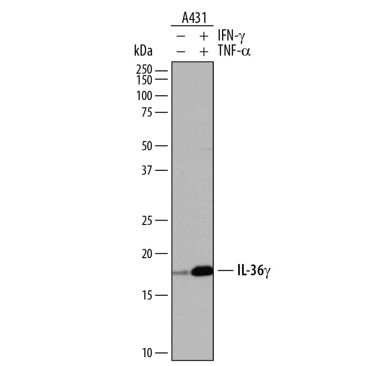 Detection of Human IL-36?/IL-1F9 antibody by Western Blot.