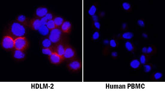IL-4I1 antibody in HDLM-2 Human Cell Line by Immunocytochemistry (ICC).
