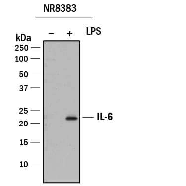 Detection of Rat IL-6 antibody by Western Blot.