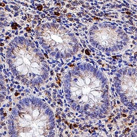 IL-6 antibody in Human Appendix by Immunohistochemistry (IHC-P).