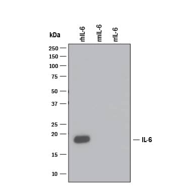 Detection of Recombinant Human IL-6 antibody by Western Blot.