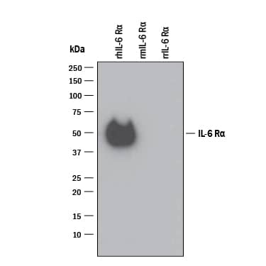 Detection of Recombinant Human IL-6R alpha antibody by Western Blot.