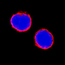 IL-6R alpha antibody in Human PBMCs by Immunocytochemistry (ICC).
