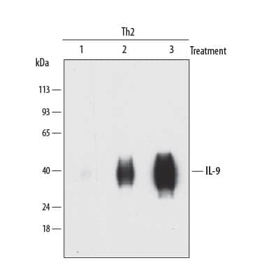 Detection of Human IL-9 antibody by Western Blot.