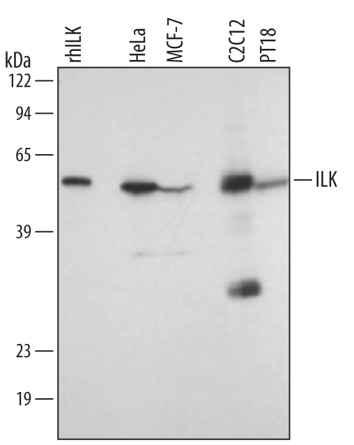 Detection of Human/Mouse/Rat ILK antibody by Western Blot.