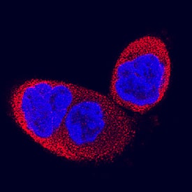 IMPA1/IMP1 antibody in HCT-116 Human Cell Line by Immunocytochemistry (ICC).