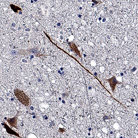IMPA1/IMP1 antibody in Human Brain by Immunohistochemistry (IHC-P).