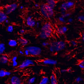 Inositol Monophosphatase 3/IMPAD1 antibody in Mouse Mesenchymal Stem Cells by Immunocytochemistry (ICC).