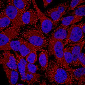 IMP Dehydrogenase 1/IMPDH1 antibody in HeLa Human Cervical Epithelial Carcinoma Cell Line by Immunocytochemistry (ICC).