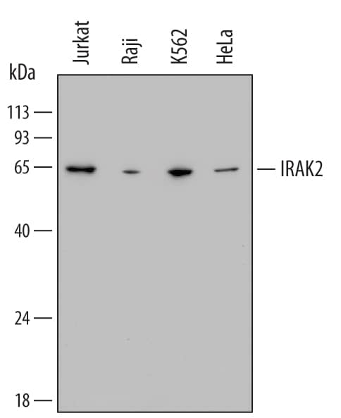 Detection of Human IRAK2 antibody by Western Blot.