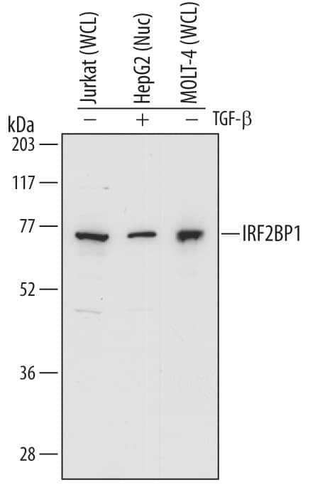 Detection of Human IRF2BP1 antibody by Western Blot.