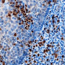 IRF4 antibody in Human Tonsil by Immunohistochemistry (IHC-P).