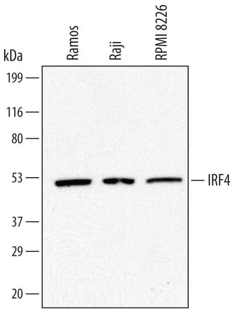 Detection of Human IRF4 antibody by Western Blot.