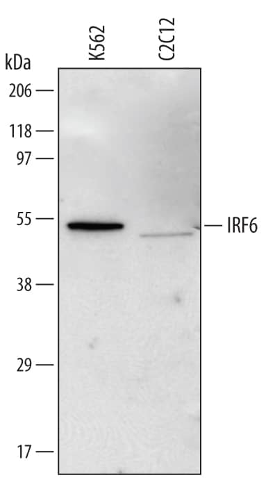 Detection of Human and Mouse IRF6 antibody by Western Blot.