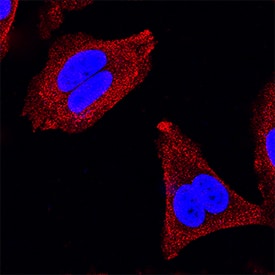 IRS1 antibody in MCF-7 Human Cell Line by Immunocytochemistry (ICC).