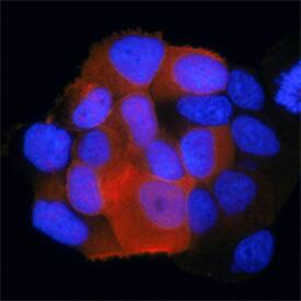 Phospho-IRS1 (Y1179) antibody in MCF-7 Human Cell Line by Immunocytochemistry (ICC).