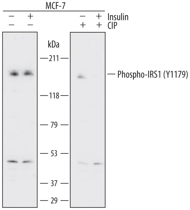 Detection of Human Phospho-IRS1 (Y1179) antibody by Western Blot.