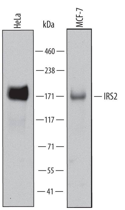 Detection of Human IRS2 antibody by Western Blot.