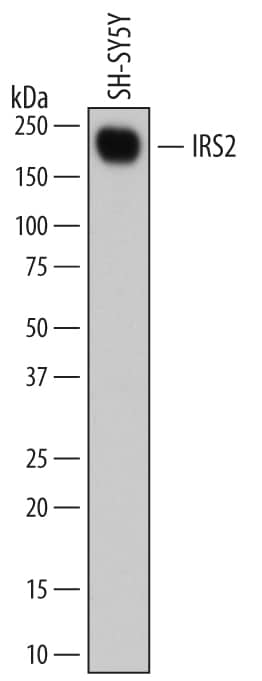 Detection of Human IRS2 antibody by Western Blot.