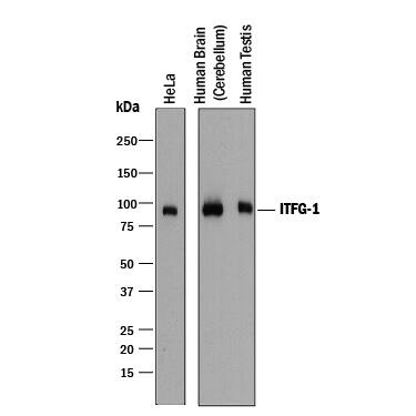 Detection of Human ITFG1 antibody by Western Blot.