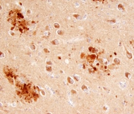 ITM2B antibody in Human Brain by Immunohistochemistry (IHC-P).