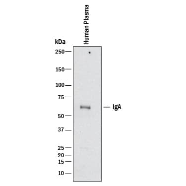 Detection of Human IgA antibody by Western Blot.