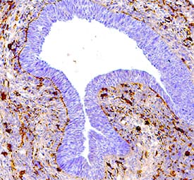 Detection of Phospho-p38 (T180/Y182) in Mouse Embryo (13 d.p.c.).