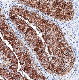 Detection of HSP27 in Human Ovary.