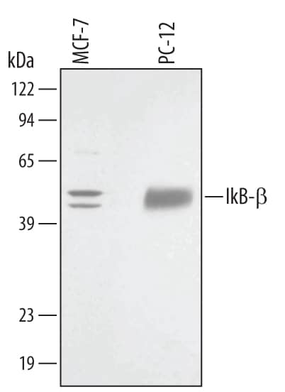 Detection of Human/Rat IkB-beta  antibody by Western Blot.