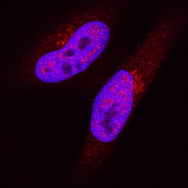 Importin a2/KPNA2 antibody in HeLa Human Cell Line by Immunocytochemistry (ICC).