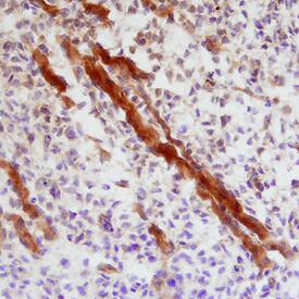 Indian Hedgehog antibody in Mouse Embryo by Immunohistochemistry (IHC-Fr).