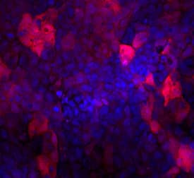 Indoleamine 2,3-dioxygenase/IDO antibody in A431 Human Cell Line by Immunocytochemistry (ICC).