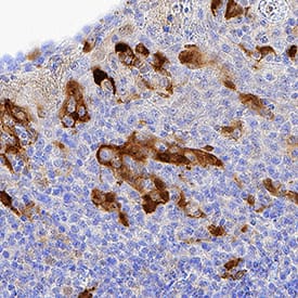 Indoleamine 2,3-dioxygenase/IDO antibody in Human Tonsil by Immunohistochemistry (IHC-P).