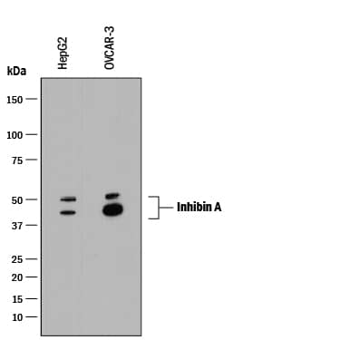 Detection of Human Inhibin A antibody by Western Blot.