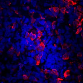 C-Peptide antibody in BG01V Human Embryonic Stem Cells by Immunocytochemistry (ICC).